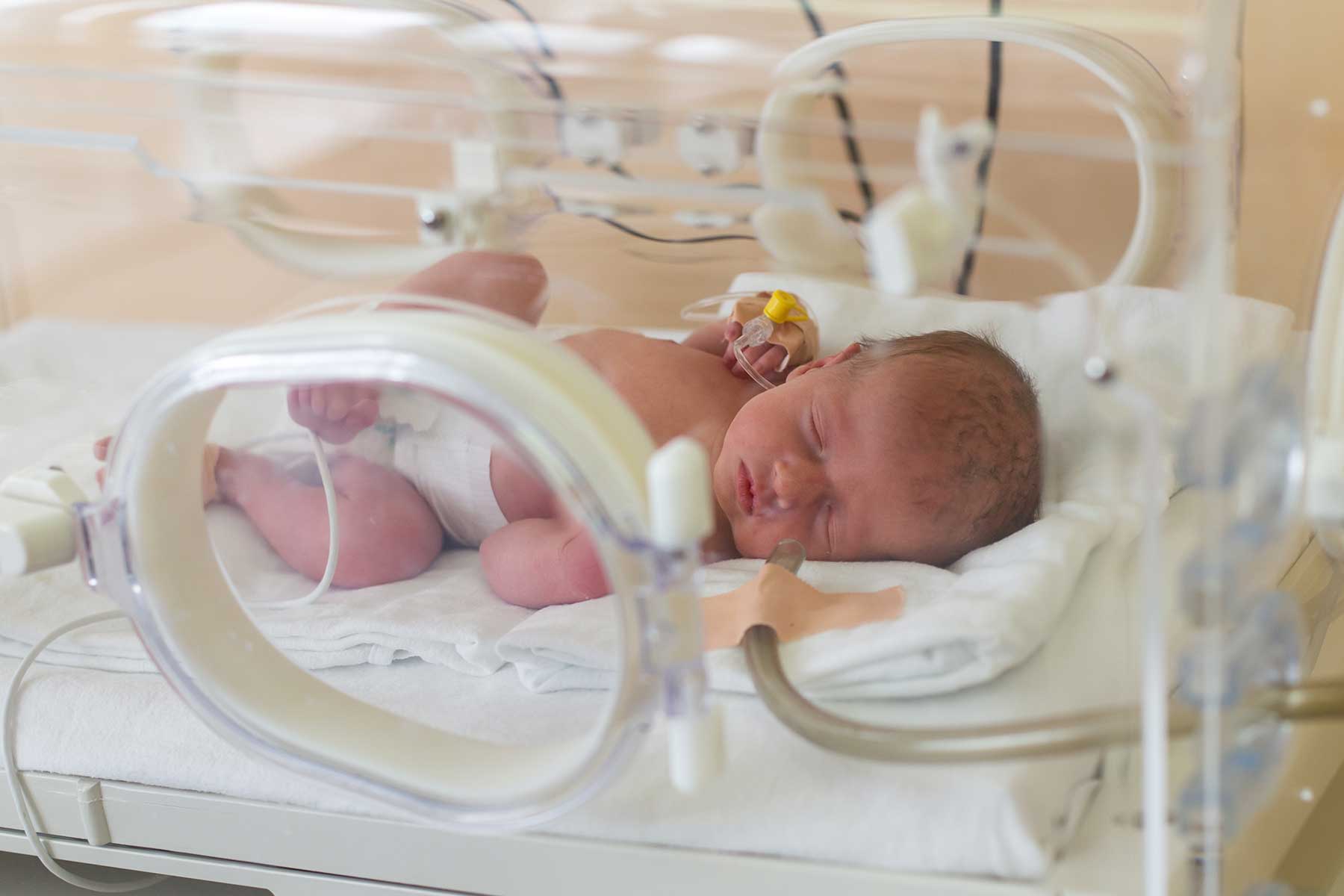 NICU